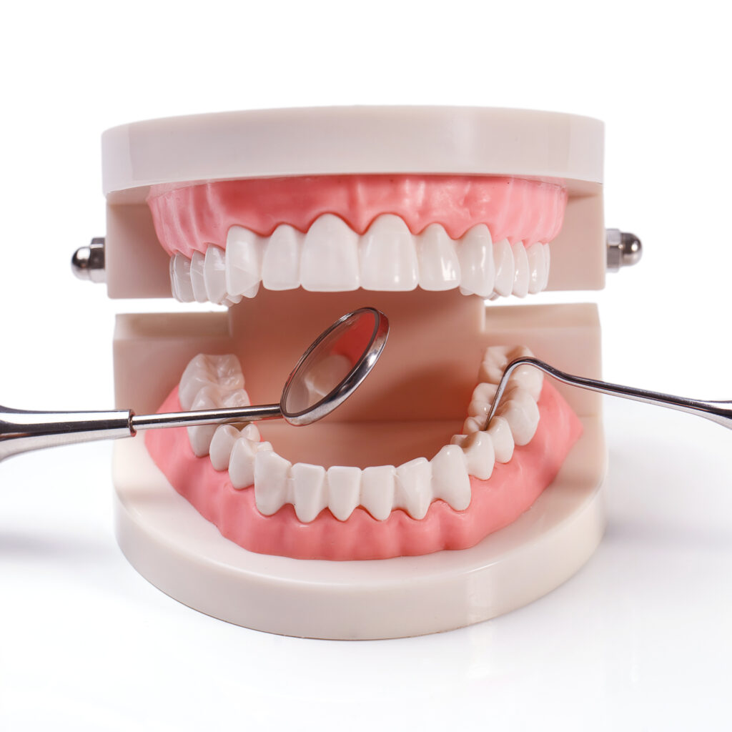 Próteses Dentárias em Maringá